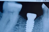 Afton Dental