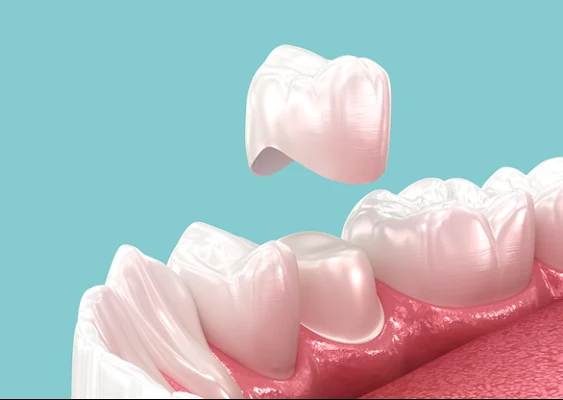 Boise Family Dental Care