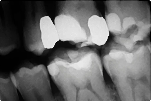 Bright Dentistry