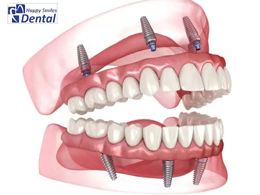 Emergency Dentist Clarksburg MD - Dr. Alireza Hamidzadeh DDS, MS at Happy Smiles Dental