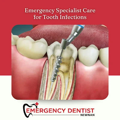 Emergency Dentist Newnan