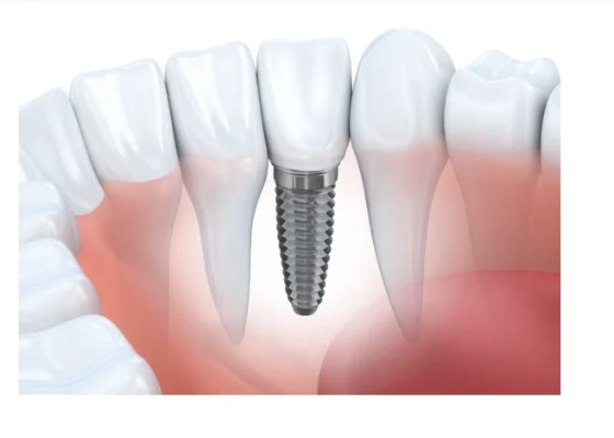 Fremont Family Dentistry