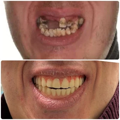 Mid Michigan Dental Center PC