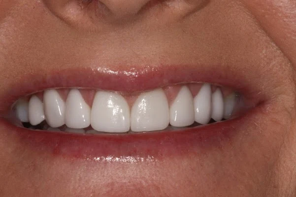 Red Rock Dental Summerlin