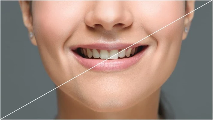 Royal Oak Family Dental of Oklahoma City