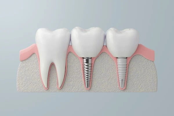 The Dental Suite PLLC