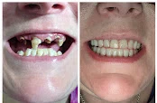 Williamsport Dental & Dentures